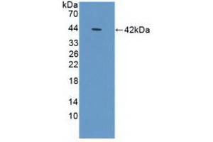 Western blot analysis of recombinant Human DEFa1B. (DEFA1B Antikörper  (AA 20-94))