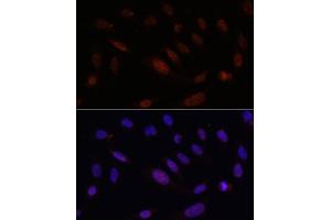 Immunofluorescence analysis of U2OS cells using Bcl9 Rabbit pAb (ABIN7265817) at dilution of 100 (40x lens). (BCL9 Antikörper)
