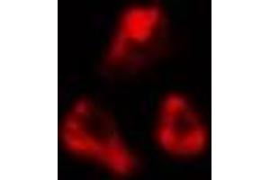 ABIN6277053 staining  LOVO cells by IF/ICC. (CDKN3 Antikörper  (Internal Region))