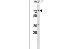 NOTUM Antibody (C-term) (ABIN1537190 and ABIN2849368) western blot analysis in MCF-7 cell line lysates (35 μg/lane). (NOTUM Antikörper  (C-Term))