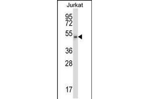 Western blot analysis in Jurkat cell line lysates (35ug/lane). (Cyclin-Dependent Kinase 15 (ALS2CR7) (AA 96-124), (N-Term) Antikörper)