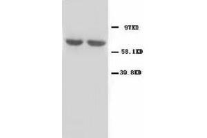 Image no. 2 for anti-Glutamate Decarboxylase 1 (Brain, 67kDa) (GAD1) (N-Term) antibody (ABIN1495050) (GAD Antikörper  (N-Term))
