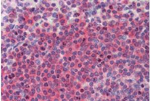 Human Spleen (formalin-fixed, paraffin-embedded) stained with  antibody ABIN462274 followed by biotinylated secondary antibody, alkaline phosphatase-streptavidin and chromogen. (BRCC3 Antikörper  (AA 1-316))