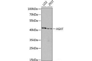 Western blot analysis of extracts of various cell lines using AGXT Polyclonal Antibody at dilution of 1:1000. (AGXT Antikörper)