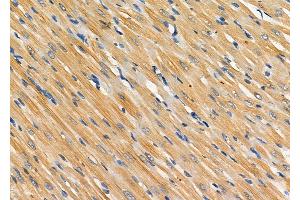 ABIN6262588 and ABIN6278484 at 1/100 staining Rat heart tissue by IHC-P.