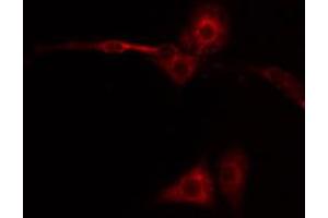 ABIN6267449 staining NIH-3T3 by IF/ICC. (CXCR2 Antikörper  (pSer347))