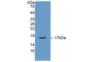 Figure. (REG3B Antikörper  (AA 27-175))