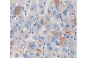 IHC-P analysis of Kidney tissue, with DAB staining. (PZP Antikörper  (AA 1246-1495))