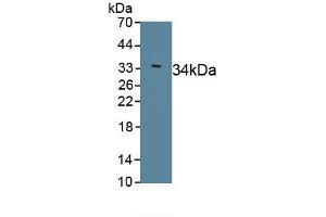 Detection of Recombinant Sarcolipin, Human using Polyclonal Antibody to Sarcolipin (SLN) (SLN Antikörper  (AA 1-31))