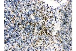 Immunohistochemistry (IHC) image for anti-Runt-Related Transcription Factor 3 (RUNX3) (AA 128-270) antibody (ABIN3043429)