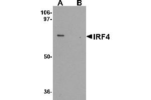 Western blot analysis of IRF4 in Jurkat cell lysate with IRF4 antibody at 1 µg/mL in (A) the absence and (B) the presence of blocking peptide. (IRF4 Antikörper  (C-Term))