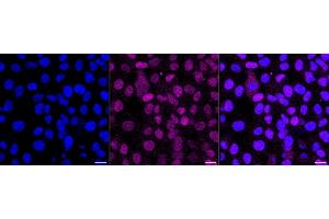 anti-Polynucleotide Kinase 3'-Phosphatase (PNKP) antibody