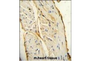 AIF1 antibody (N-term) (ABIN654407 and ABIN2844145) immunohistochemistry analysis in formalin fixed and paraffin embedded mouse heart tissue followed by peroxidase conjugation of the secondary antibody and DAB staining. (Iba1 Antikörper  (N-Term))