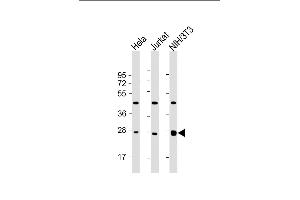 All lanes : Anti-EIF4E Antibody at 1:2000 dilution Lane 1: Hela whole cell lysate Lane 2: Jurkat whole cell lysate Lane 3: NIH/3T3 whole cell lysate Lysates/proteins at 20 μg per lane. (EIF4E Antikörper)