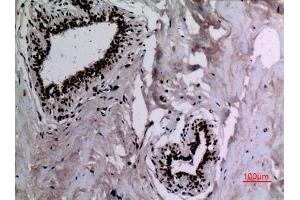 Immunohistochemical analysis of paraffin-embedded human-breast, antibody was diluted at 1:100. (HSP90 Antikörper  (acLys284, acLys292))