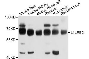 Western blot analysis of extracts of various cells, using LILRB2 antibody. (LILRB2 Antikörper)