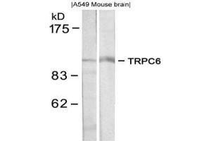 Image no. 1 for anti-Transient Receptor Potential Cation Channel, Subfamily C, Member 6 (TRPC6) (N-Term) antibody (ABIN319369) (TRPC6 Antikörper  (N-Term))
