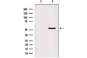 Western blot analysis of extracts from HepG2, using BCS1L antibody.