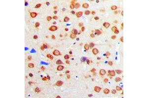 Immunohistochemical analysis of IGF1 Receptor staining in human brain formalin fixed paraffin embedded tissue section. (IGF1R Antikörper  (C-Term))