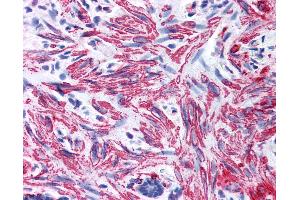 Anti-MYL9 antibody IHC of human smooth muscle. (MYL9 Antikörper  (AA 12-27))