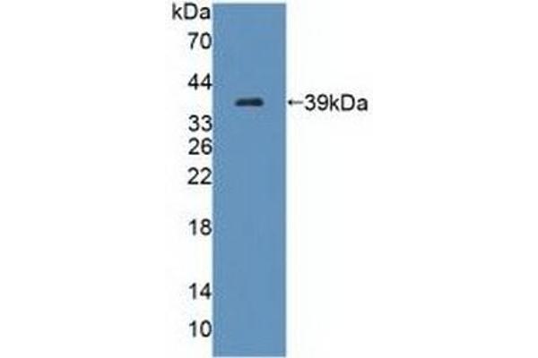 TECTB Antikörper  (AA 18-329)