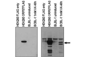 Image no. 1 for anti-Herpes Virus Type 8 (HHV8) (C-Term) antibody (ABIN401445) (HHV8 Antikörper  (C-Term))