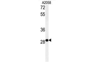 C11orf46 Antibody (C-term) western blot analysis in A2058 cell line lysates (35µg/lane).