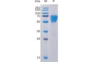 Human CD27 Protein, mFc-His Tag on SDS-PAGE under reducing condition.