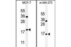 (LEFT)Western blot analysis of BTG1 Antibody (Center) (ABIN651304 and ABIN2840179) in MCF-7 cell line lysates (35 μg/lane). (BTG1 Antikörper  (AA 92-118))