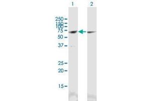 Western Blot analysis of CCT3 expression in transfected 293T cell line (CCT3 Antikörper  (AA 1-544))