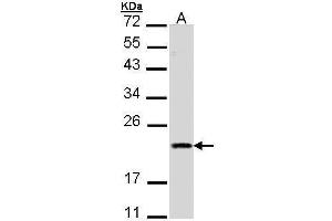WB Image Sample (30 ug of whole cell lysate) A: A431 , 12% SDS PAGE antibody diluted at 1:1000 (DIABLO Antikörper)