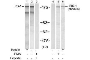 Image no. 2 for anti-Insulin Receptor Substrate 1 (IRS1) (pSer636) antibody (ABIN196978) (IRS1 Antikörper  (pSer636))