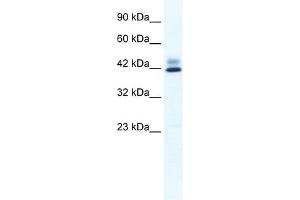 Western Blot showing ZNF551 antibody used at a concentration of 1-2 ug/ml to detect its target protein. (ZNF551 Antikörper  (N-Term))