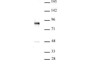 PKC-B antibody (pAb) tested by Western blot. (PKC beta Antikörper  (C-Term))