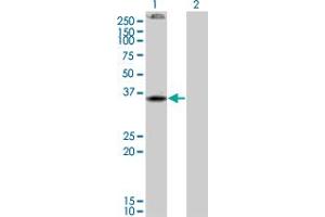 Western Blot analysis of CNR2 expression in transfected 293T cell line by CNR2 monoclonal antibody (M01), clone 3C7. (CNR2 Antikörper  (AA 302-360))