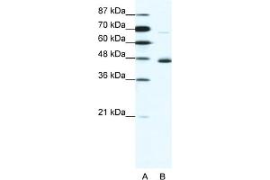 WB Suggested Anti-NEUROD1 Antibody Titration:  1. (NEUROD1 Antikörper  (N-Term))