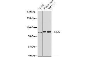 Western blot analysis of extracts of various cell lines using KIF2B Polyclonal Antibody at dilution of 1:1000. (KIF2B Antikörper)
