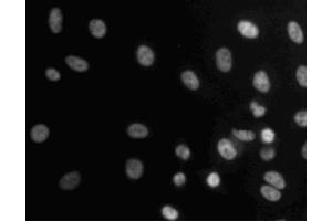 Immunofluorescent staining of A549 (ATCC CCL-185) cells.