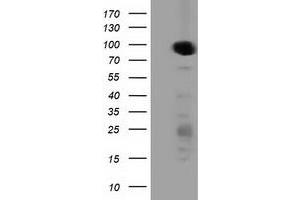 Western Blotting (WB) image for anti-Protein Kinase D2 (PKD2) antibody (ABIN1500410)