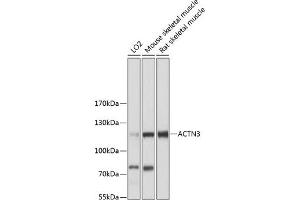 Western blot analysis of extracts of various cell lines, using  antibody  at 1:3000 dilution. (ACTN3 Antikörper  (AA 580-630))