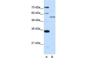 Western Blotting (WB) image for anti-Zinc Finger Protein 707 (ZNF707) antibody (ABIN2462009) (ZNF707 Antikörper)
