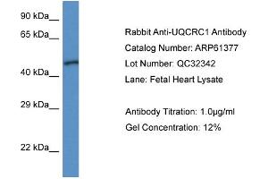 Western Blotting (WB) image for anti-Ubiquinol-Cytochrome C Reductase Core Protein I (UQCRC1) (N-Term) antibody (ABIN2788783) (UQCRC1 Antikörper  (N-Term))