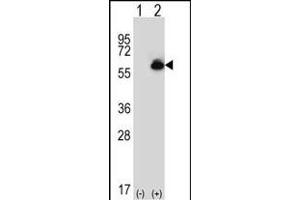 Western blot analysis of ALDH4A1 (arrow) using rabbit polyclonal ALDH4A1 Antibody (C-term) (ABIN392356 and ABIN2841995). (ALDH4A1 Antikörper  (C-Term))