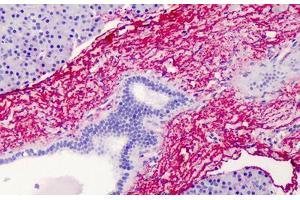 Human Pancreas: Formalin-Fixed, Paraffin-Embedded (FFPE) (Elastin Antikörper)