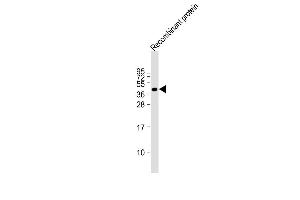 FAT4 recombinant protein at 20 µg per lane, probed with bsm-51360M FAT4 (1654CT645.
