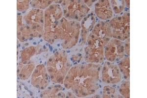 Used in DAB staining on fromalin fixed paraffin- embedded Kidney tissue (CTBP1 Antikörper  (AA 1-250))