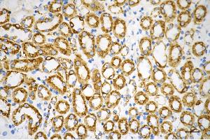 Immunohistochemistry was performed on paraffin-embedded mouse kidney using hexokinase 1 antibody (ABIN7798906), 1:200). (Rekombinanter Hexokinase 1 Antikörper)