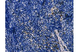 ABIN6266100 and ABIN6278545 at 1/100 staining mouse spleen tissue by IHC-P. (ZNF598 Antikörper  (N-Term))