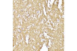 Immunohistochemistry of paraffin-embedded human brain using Synaptophysin Rabbit pAb (ABIN6135349, ABIN6148783, ABIN6148784 and ABIN6221958) at dilution of 1:200 (40x lens). (Synaptophysin Antikörper  (AA 150-250))