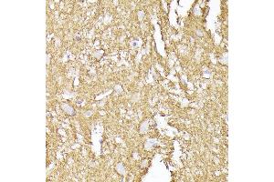 Immunohistochemistry of paraffin-embedded human brain using Synaptophysin Rabbit pAb (ABIN6135349, ABIN6148783, ABIN6148784 and ABIN6221958) at dilution of 1:200 (40x lens).